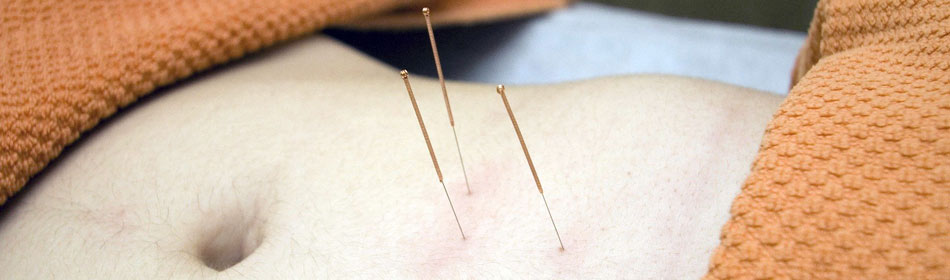 Accupuncture, Eastern Healing Arts in the Frenchtown, Hunterdon County NJ area